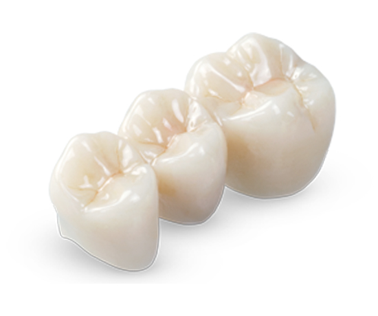 Illusion Zirconia Premium Plus powered by BruxZir®