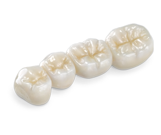 Illusion Zirconia Premium Plus powered by BruxZir®