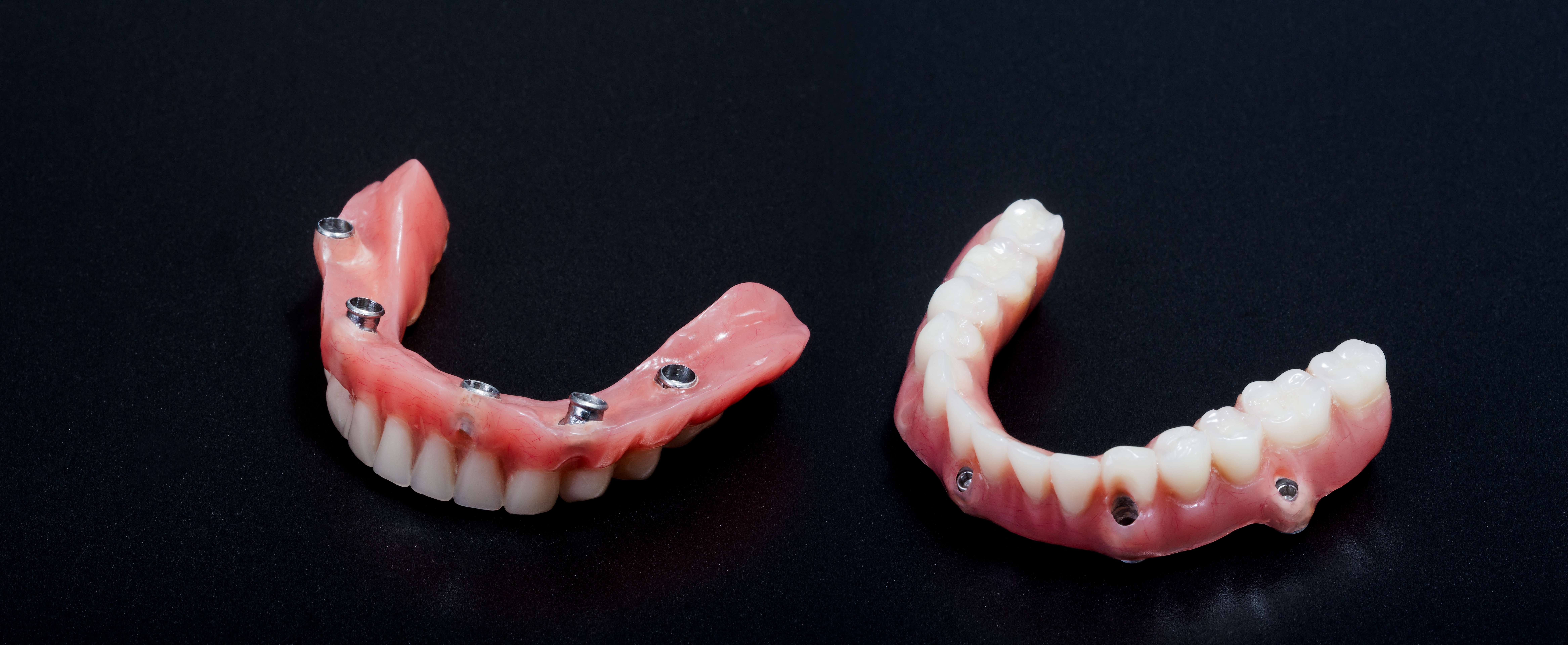 Hybrid Denture