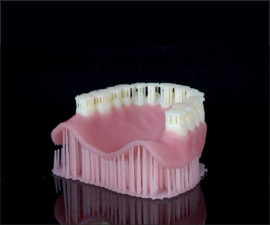 Digital Denture