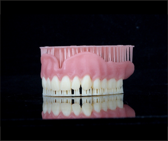 Digital Denture