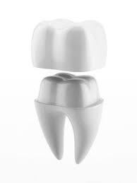 metal-dental-products