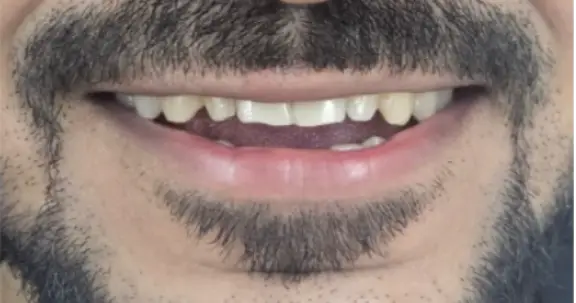 gap