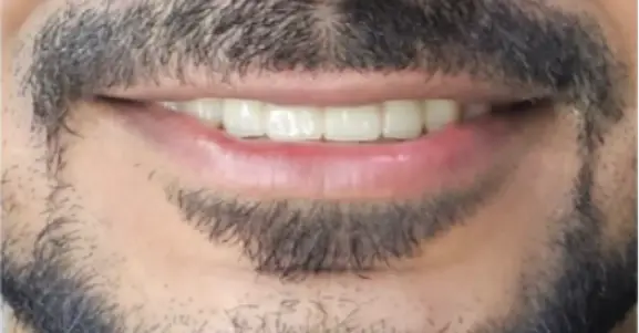 gap