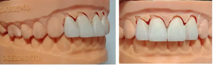gap